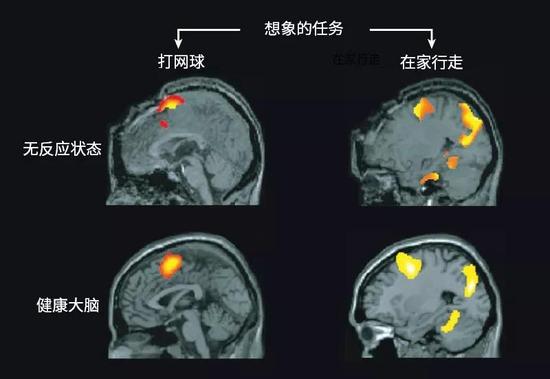 部分患者看起来对外界刺激无反应，但是其大脑活动与健康个体的类似。