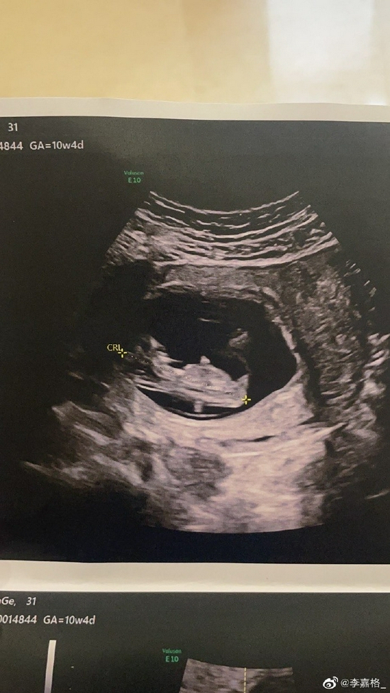 /images/20210802/62a9c8a66c35c9c3da496642bd5aff1b.jpg 245a-23e285a9ed16d092e01e9bf6284ce729.jpg