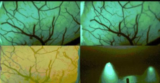图｜Neuralink展示探针设备成功插入过程（来源：Neuralink）